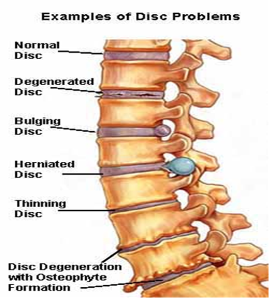 Pilates & Musculo-Skeletal Conditions - Drummond Education