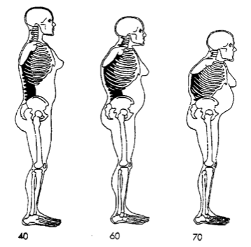 postures